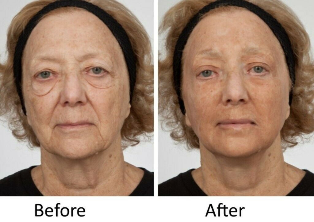 Dr Sevinor Genuine-Original Amazing Wrinkle Solution Wrinkle Smoothing Tinted Serum  2-Pack Special Save 10% 2oz. As Seen on TV SAVE 10%