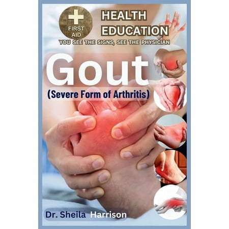 Sheila's Health Education Book Shelf: You See the Signs, See the Physician: Gout: Severe Form of Arthritis: Causes, Symptoms, Risk Modifiers Management, Treatment, MEDICATIONS(APPROVED BY ADA), Preven