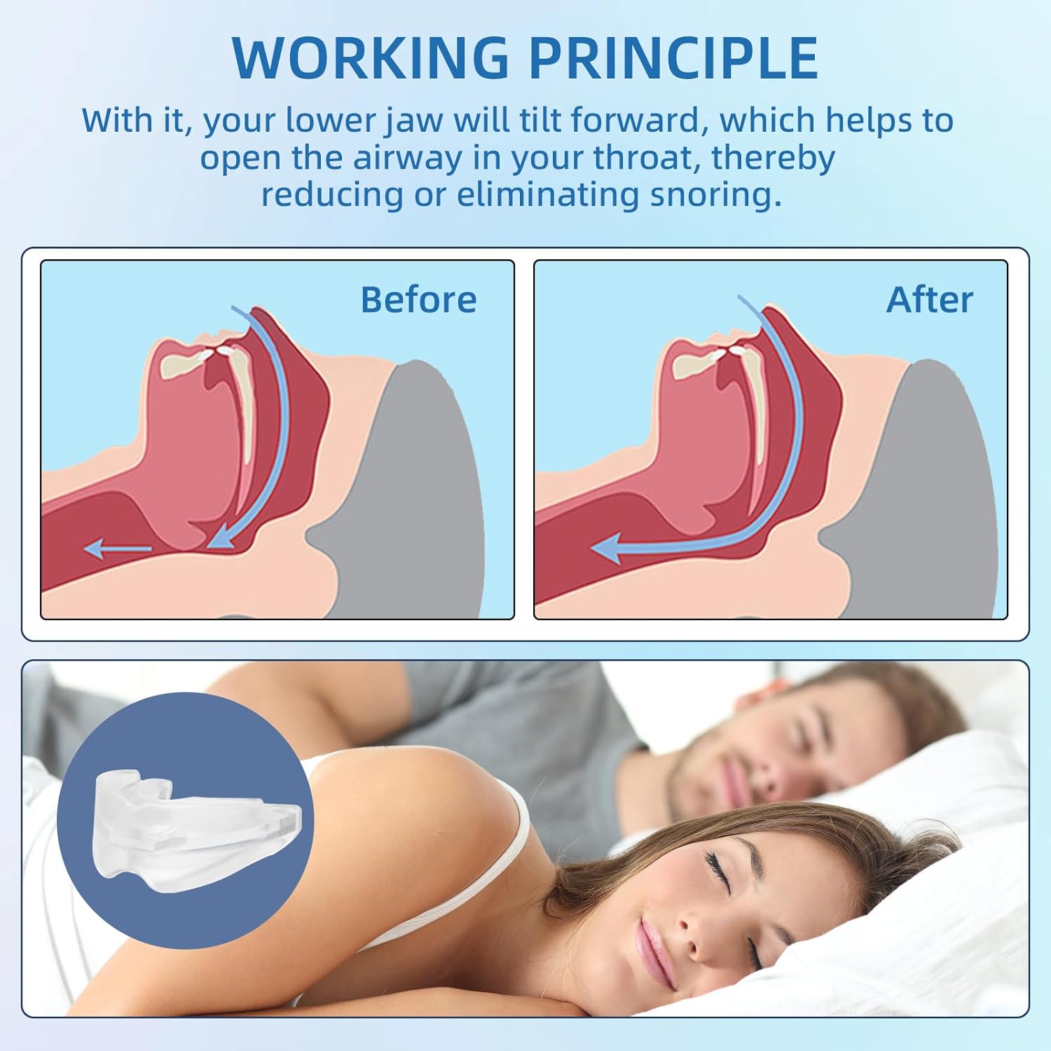 YJJSKEJI Anti-Snoring Mouth Guard, Anti-Snoring Mouthpiece, Snoring Solution Comfortable Anti-Snoring Devices for Man a Better Night's Sleep