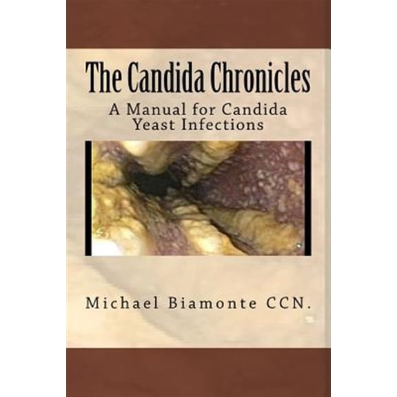 Pre-Owned The Candida Chronicles: A Manual for Candida Yeast infections: A Mannual for Candida/Yeast Infections: Volume 1 Paperback