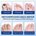thumbnail image 4 of Fungal Nail Patches JOYJAR Extra Strength 21 Patches, 4 of 6