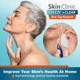 thumbnail image 3 of Skin Clinic FREEZE 'n CLEAR Skin Tag Remover, 3 of 8