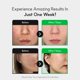 thumbnail image 3 of Crema hidratante facial NEUL20S Centelsome 5X, crema calmante, 50 ml, 3 of 9