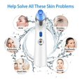 thumbnail image 5 of El limpiador de poros facial más nuevo y mejorado, extractor eléctrico de acné C, kit de aspiradora recargable por USB para mujeres y yo, azul, 5 of 5