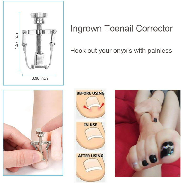 Manicure pedicure set for painless correction of ingrown nails - .  Gift Ideas