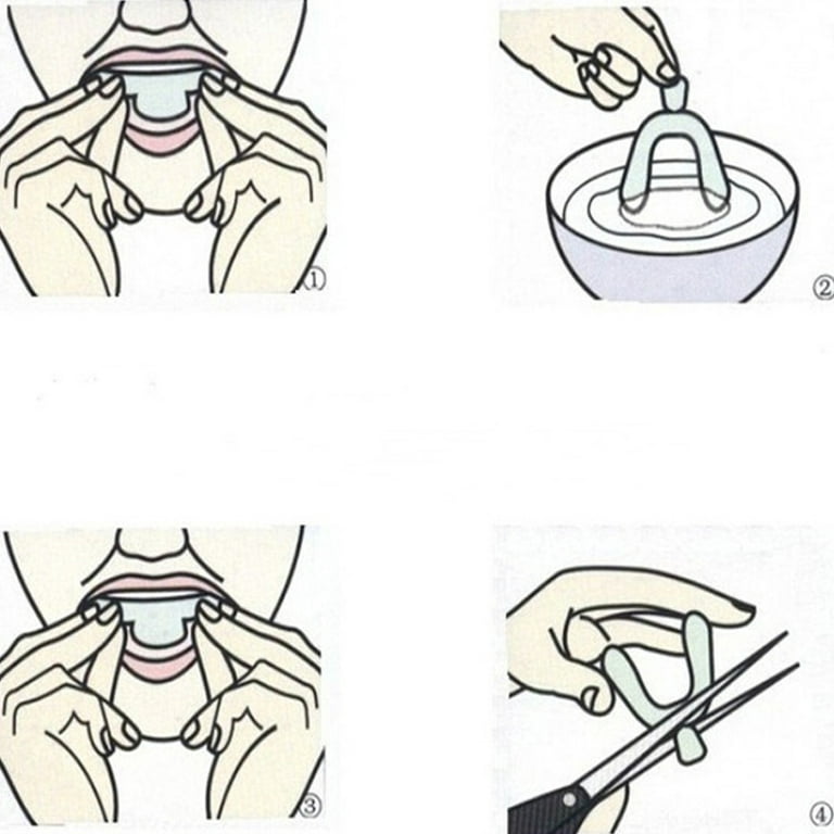 moldable mouth tray crooked teeth｜TikTok Search