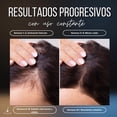 thumbnail image 3 of Minoxidil 7% Mens Hair Lab | Tratamiento Capilar Antica&iacute;da | Crecimiento de Cabello, Barba y Bigote | Unisex | Alta Concentraci&oacute;n | Serum Capilar 50ml (Duo Pack), 3 of 6