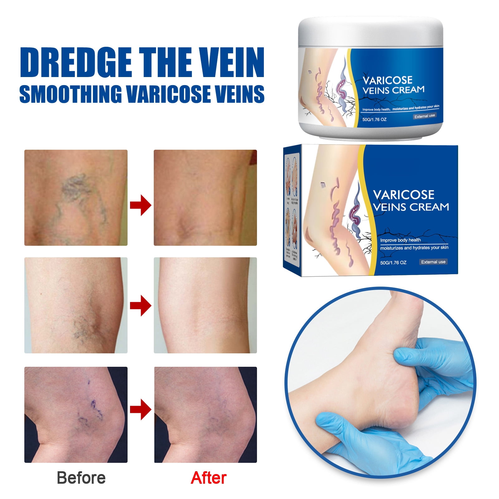 Alvantor Varicose Cream Soothing Vein Relief Leg Cream for Tired Legs 1.76oz