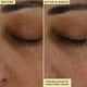 thumbnail image 5 of Crema para ojos Farmacy Wake Up Honey Brightening con vitamina C, 15 ml, 5 of 9