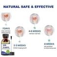 thumbnail image 4 of Fungal Nail Treatment - 30ml Extra Strong Nail Fungus Treatment for Toenail - Anti Fungus Nail Repair and Strengthen, 4 of 5