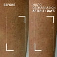 thumbnail image 2 of Dr. Brandt Microdermabrasion Body Polishing Exfoliator, 2 of 7
