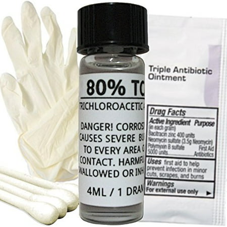 80% TCA Skin Peel Kit - Acid Peel - Age Spots, Stretch Marks, Acne Scars, Scars, Hyperpigmentation, Wrinkles & (Best Peel For Acne Scars)
