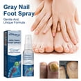 thumbnail image 4 of Antifungals Nail Treatments Spray In Medicals Quality, 30 Ml, Antifungals Nail Treatments, Antifungals Spray 30ml, 4 of 5
