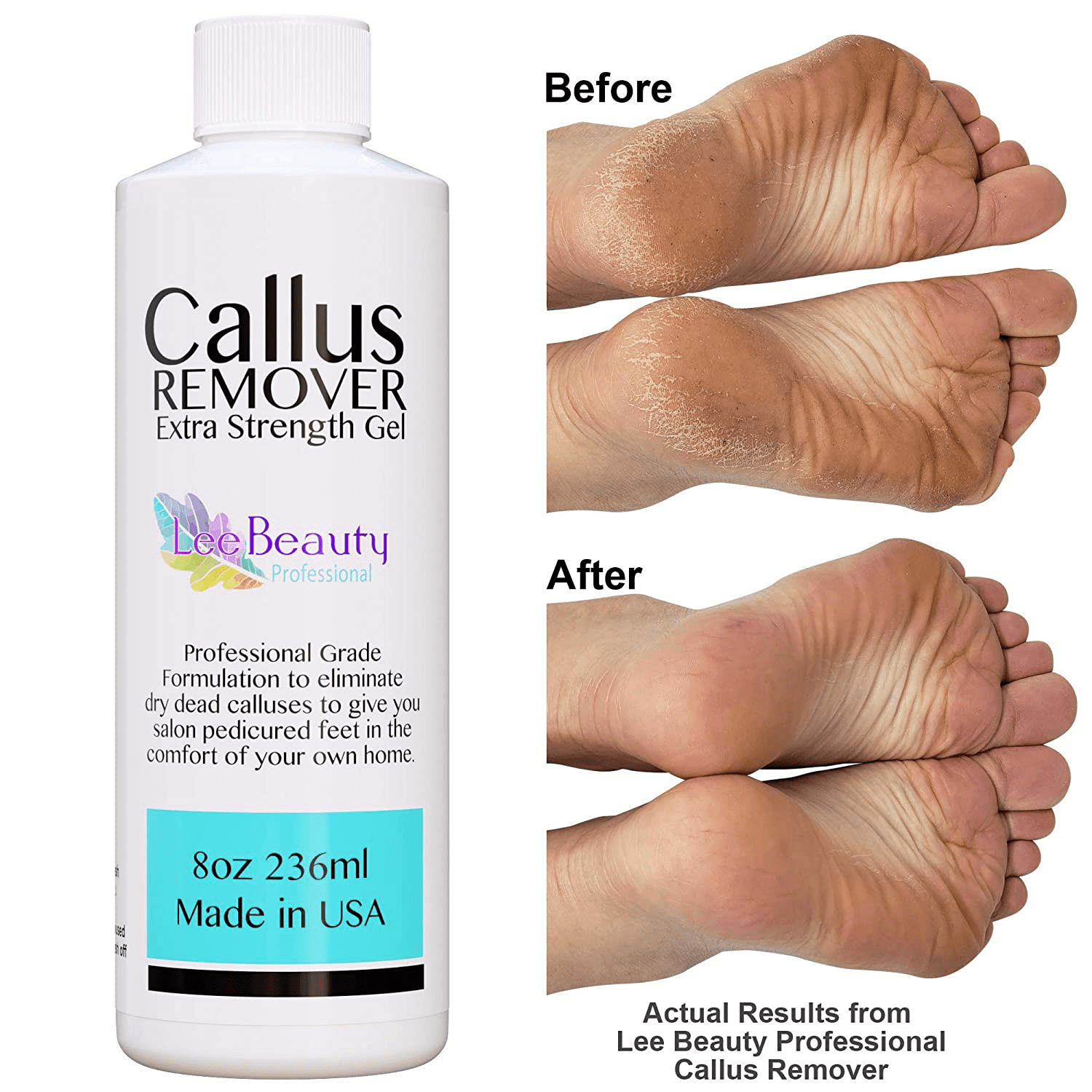 Pro feet. Пилинг для ног Callus Remover. Эффективное средство для удаления натоптышей. Callus гель.