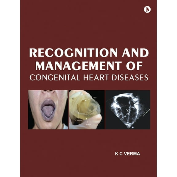 Recognition and Management of Congenital Heart Diseases, (Paperback)
