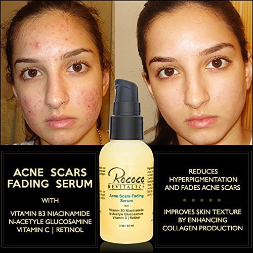 Acne removal fading Vitamin C Serum and Vitamin B3 Serum - 60ml 2oz - Walmart.com