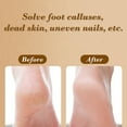 thumbnail image 5 of Molinillo para Pies XWSHYW Eliminación de Callos Pedicura Exfoliante, 5 of 5