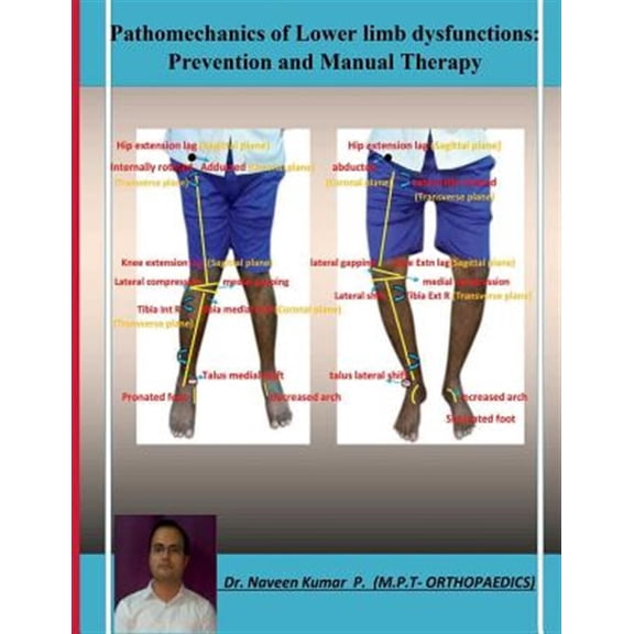 Pre-Owned Pathomechanics of Lower limb dysfunctions: Prevention and Manual Therapy (Paperback)