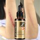 thumbnail image 5 of Aceites esenciales yaluronic Piel AntiAge Acné 30ml Clearance Essential Oils, 5 of 8