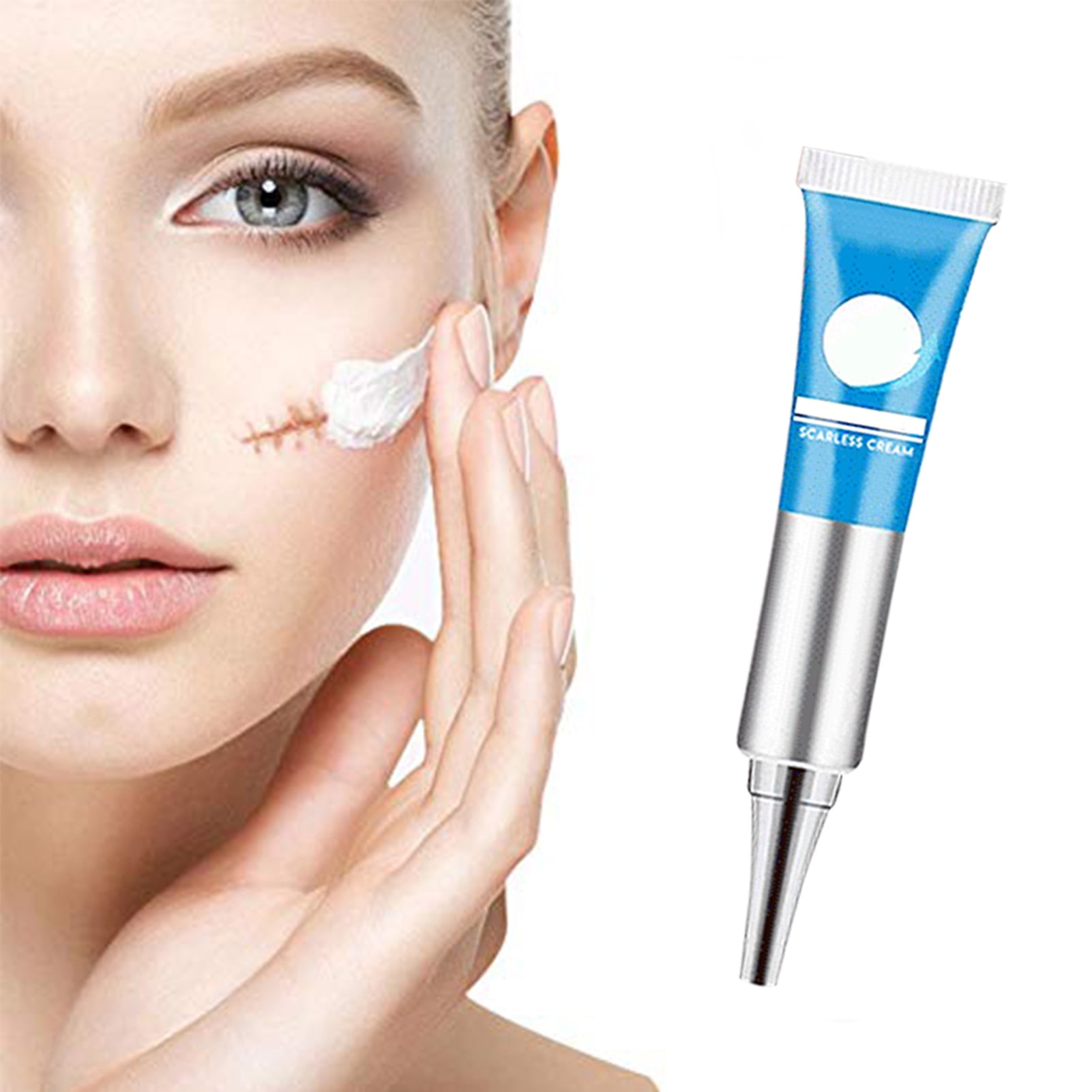 Blackhead Acne Scar Removal Cream Repair Gel Ointment Skin Care