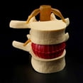 thumbnail image 2 of Transemion Flexible And Compact Anatomical Spine Lumbar Disc Model Versatile And Practical For Training yellow 1Set, 2 of 6