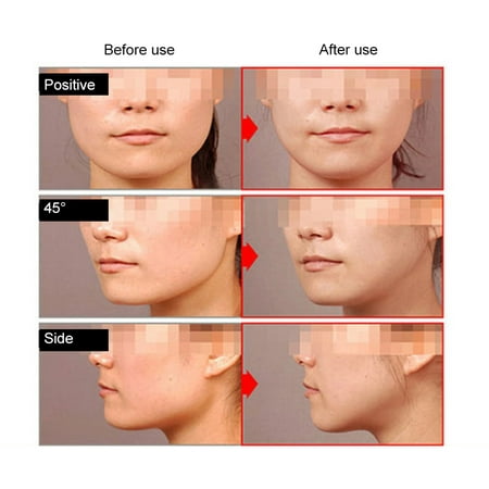 Ejoyous Lifting Facial Mask V Shape Face Slim Chin Check Neck Lift Firming Whitening Pulling Mask, V Face Mask, Lift Peel-off