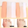 thumbnail image 4 of Relieve Painness Toe Separator Silicone Gel Finger Tube Protector Foot Cover Remover Bunion Corrector Pedicure Foot Care Tools, 4 of 6