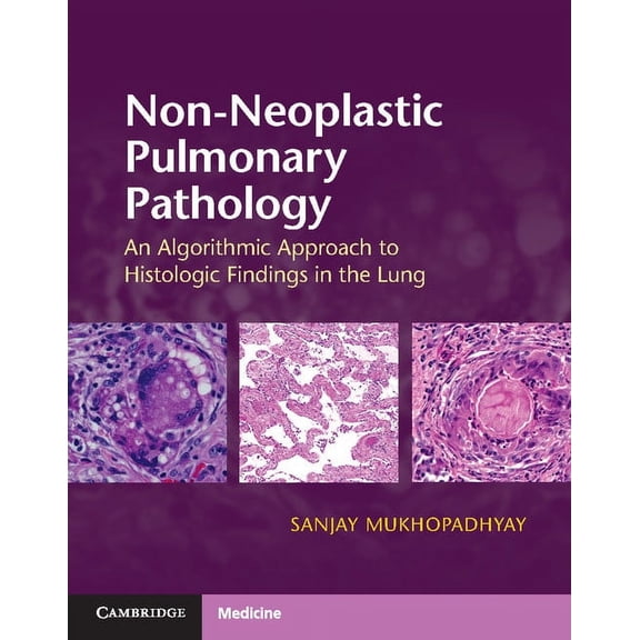 Non-Neoplastic Pulmonary Pathology with Online Resource: An Algorithmic Approach to Histologic Findings in the Lung, (Paperback)