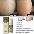 thumbnail image 3 of 3pcs Antibacterial Foot Spray - South Moon, Anti Itch, Sweat Odor Control, Exfoliating, Men Women, Anti-fungal Shoe, 3 of 5