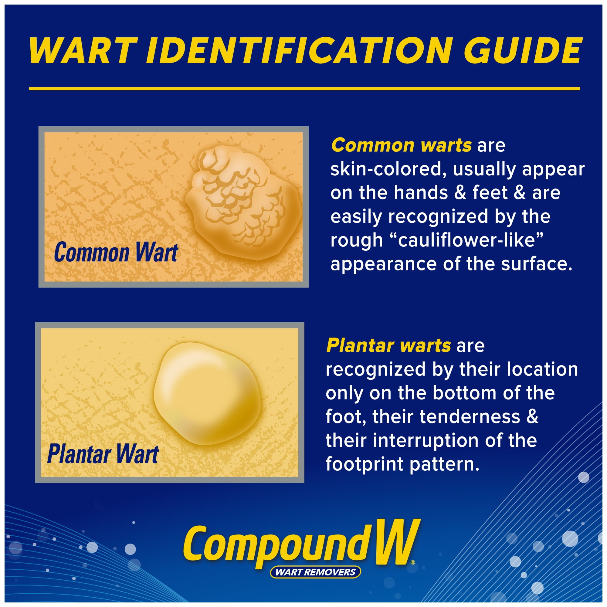 Compound W Freeze Off Wart Remover, 8 Applications – Locatel