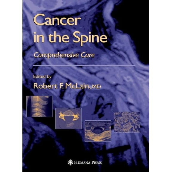 Current Clinical Oncology Cancer in the Spine: Comprehensive Care, (Hardcover)