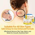 thumbnail image 4 of Crema para la piel con veneno de abeja, suave e indolora, para eliminar verrugas, para mujeres y hombres (1-3 unidades), 4 of 5