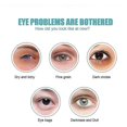 thumbnail image 5 of Crema para Ojos Yuxing Antiarrugas Instantánea que Atenúa las Ojeras y Antienvejecimiento 5 Piezas, 5 of 5
