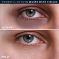 thumbnail image 6 of RoC Derm Correxion Eye Repair Dark Circle Cream, Patented Clinical Retinol + Niacinamide, Fragrance-Free & Paraben-Free, 0.5 fl oz (15 mL), 6 of 11