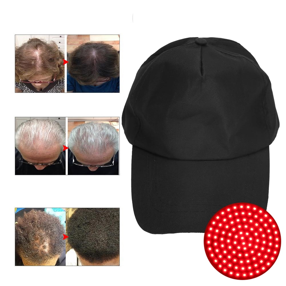 Hair Loss Treatment Therapy Instrument 