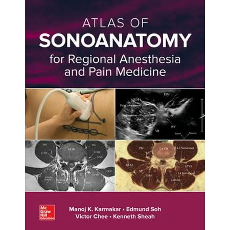 Atlas of Sonoanatomy for Regional Anesthesia and Pain Medicine -