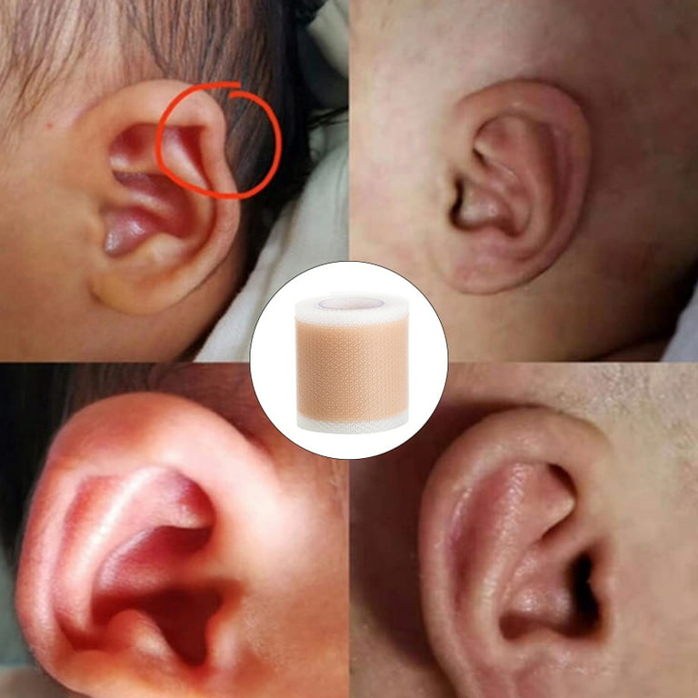 Baby Ear Correctors Medical Silicone Tape Infant Ear Correction Pa-ssSSWA