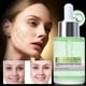 thumbnail image 5 of Pisexur Belleza Maquillaje Suero facial con ácido hialurónico Azelaic 10 para piel sensible, color natural, vegano, 30 mlpara mujeres y hombres, 5 of 9