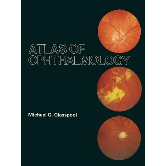 Atlas of Ophthalmology, (Paperback)