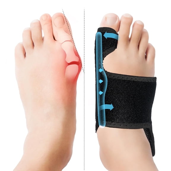 2-Pack Bunion Corrector For Women & Men Big Toe, Orthopedic Bunion Splint For Women Men Pain Relief, Big Toe Straightener Night Splint For Heel Pain