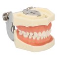 thumbnail image 3 of Modelo de preparación dental, modelo dental de quiste maxilar, modelo de dientes de quiste, modelo educativo de quiste dental, rendimiento inigualable, 3 of 8