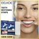 thumbnail image 1 of 14 Uds pegatinas para blanquear los dientes Gel blanqueador tiras para blanquear los dientes cuidado de los dientes Likrtyny Cuidado Belleza, 1 of 8