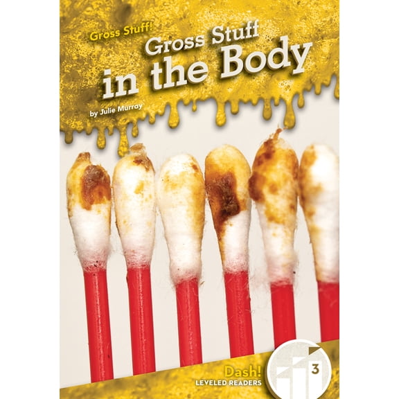Gross Stuff! Gross Stuff in the Body, (Hardcover)