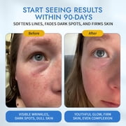 Maelove Moonlight Advanced Retinal Super Serum, 10x Stronger than Regular Retinol