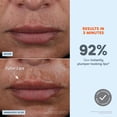 thumbnail image 4 of Dispositivo facial NuFace FIX MicroWand con activador de sérum, 4 of 9