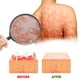 thumbnail image 3 of Crema calmante para herpes zóster de 20 g, crema para el tratamiento del herpes zóster y para aliviar el dolor del herpes zóster en el rostro y el cuerpo, bálsamo para aliviar el dolor del herpes zós, 3 of 4