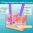 thumbnail image 3 of Dimora UPF50+ Silicone Scar Sheets - UV Protection Medical Grade Silicone Scar Tape for C-Section, Surgery, Keloid & Burn Scars - Reusable, Breathable & Flexible (1.6” x 79” Roll), 3 of 11
