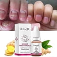 thumbnail image 3 of essential oil for nail fungus ginger 10ml, 3 of 5