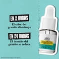 thumbnail image 2 of Kiehl's Truly Targeted Blemish-Clearing Solution, Solución Eliminadora de Acné, Tratamiento Líquido Invisible para Acné y Espinillas, Desvanece Manchas e Im, 2 of 5