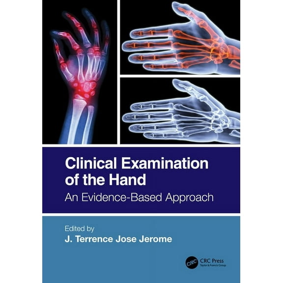 Clinical Examination of the Hand: An Evidence-Based Approach, (Paperback)